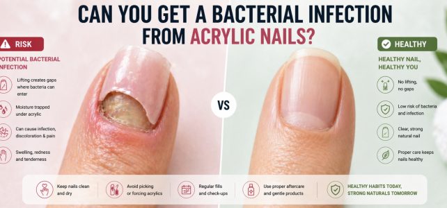 Can You Get a Bacterial Infection from Acrylic Nails?